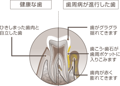 相馬市中村字塚田・馬陵歯科診療所・歯のメンテナンスをご存知ですか？